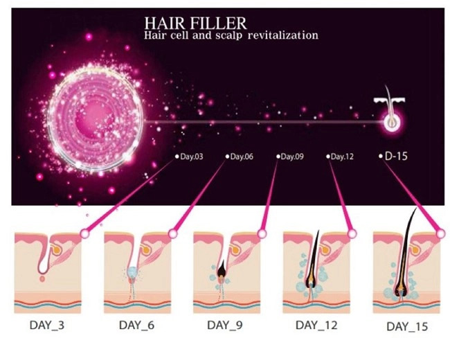 هیرفیلر دکتر سی وای جی ولکا طب 09939646852  پخش عمده ژل و بوتاکس